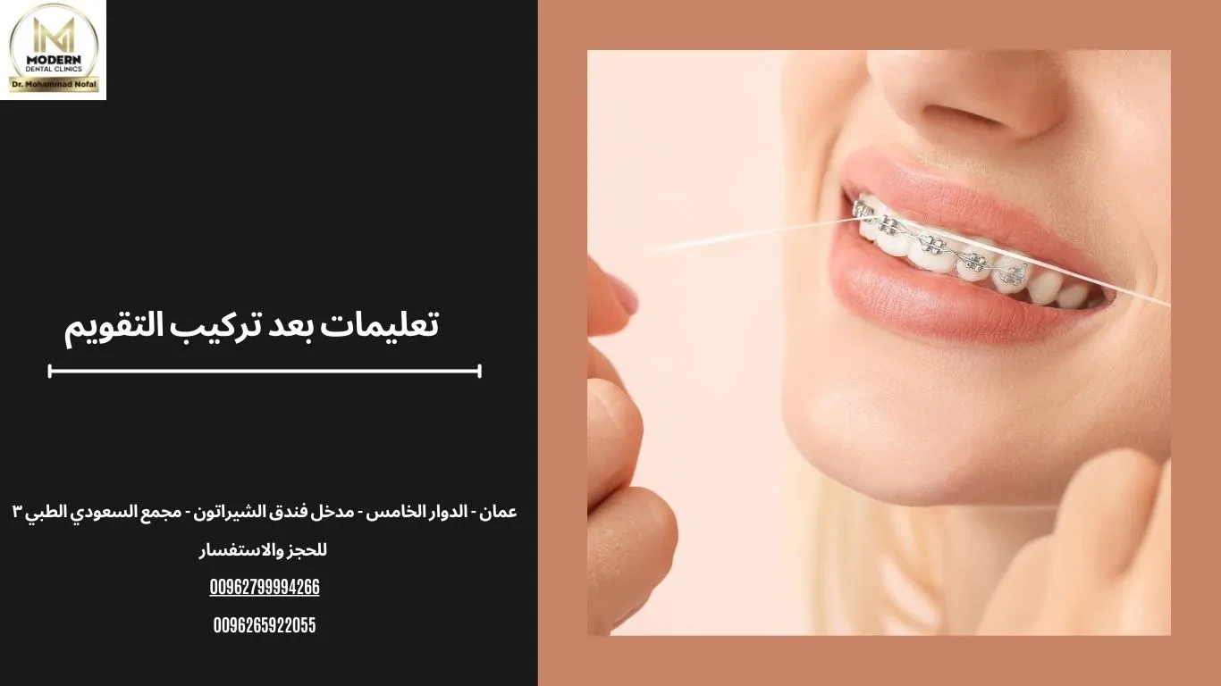 تعليمات ما بعد تركيب تقويم الاسنان