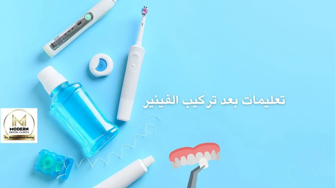 ما بعد تركيب الفينيرز