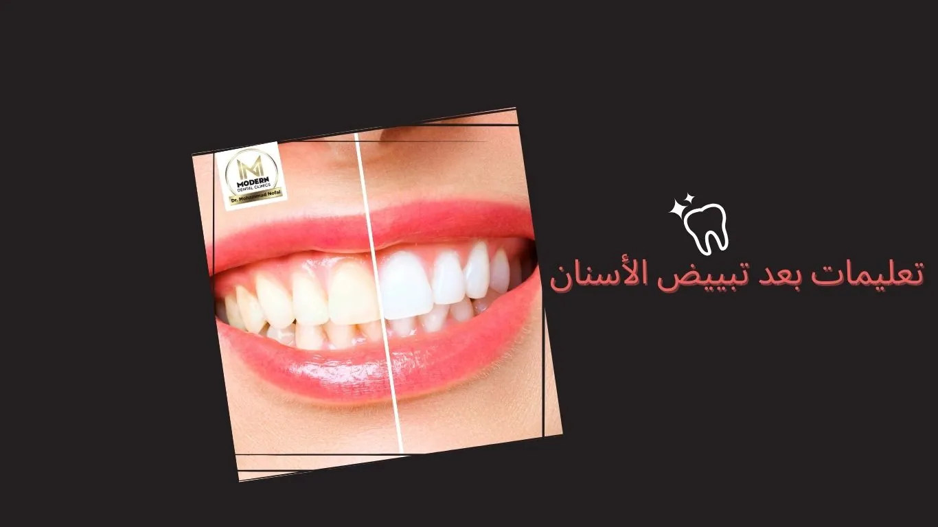 تعليمات وارشادات ما بعد تبييض الاسنان