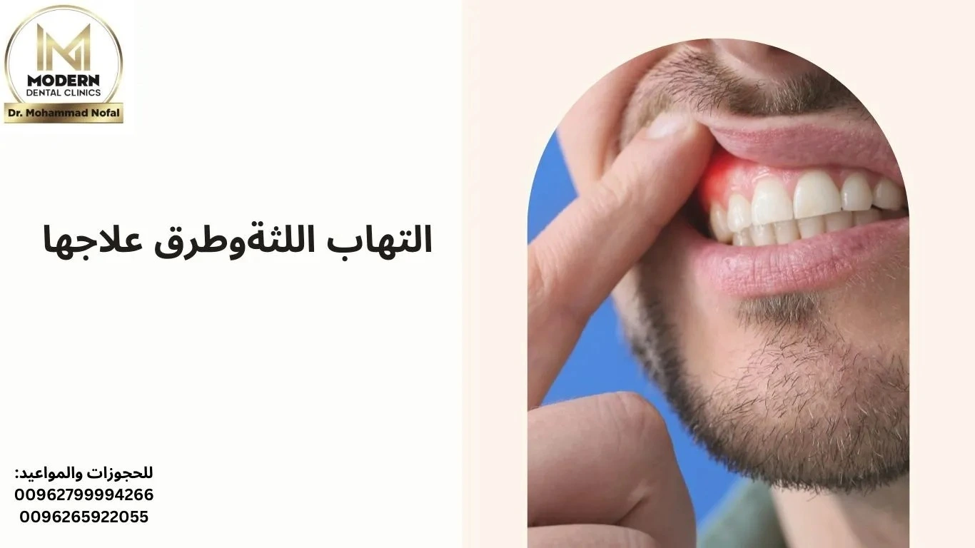 التهاب اللثة وطرق علاجها