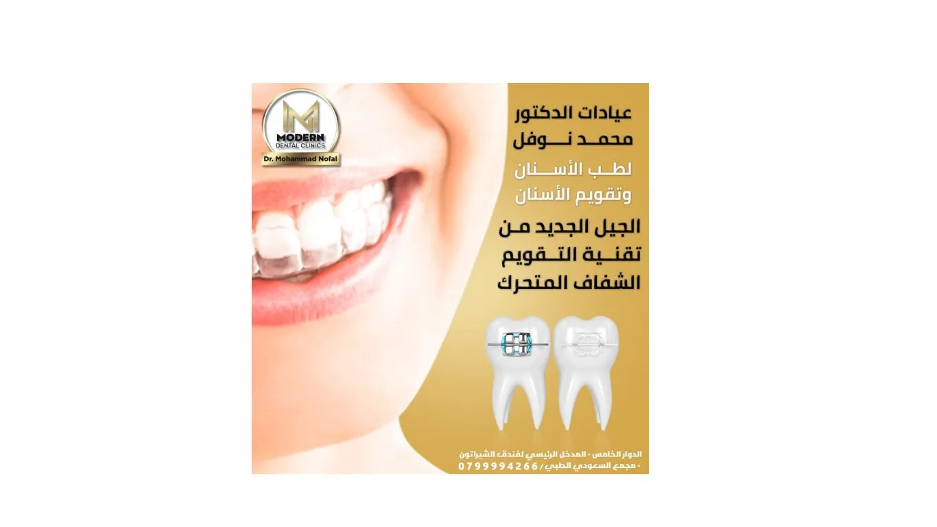 تقويم الأسنان وأنواعه الحديثة