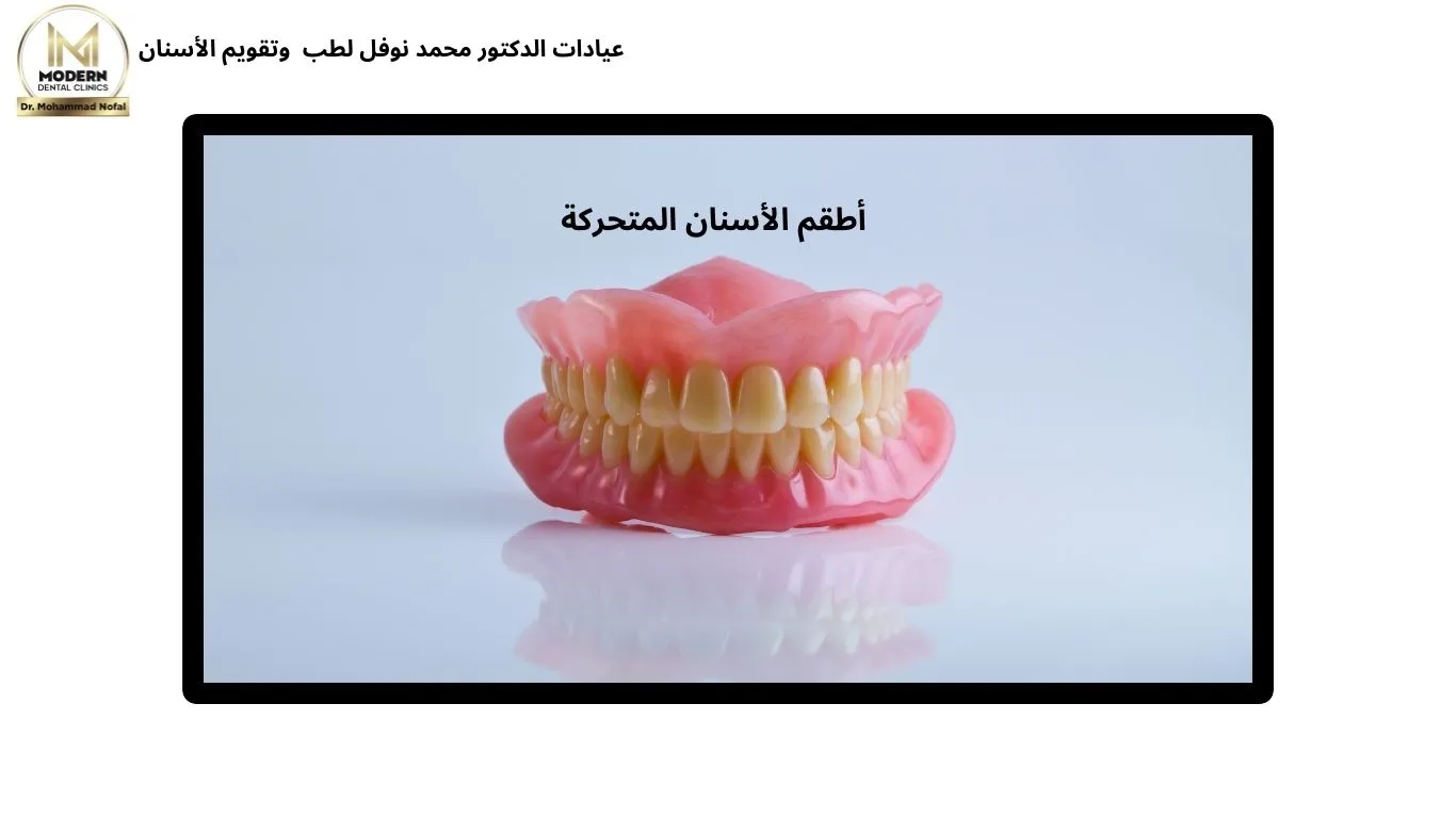 طقم الاسنان المتحرك