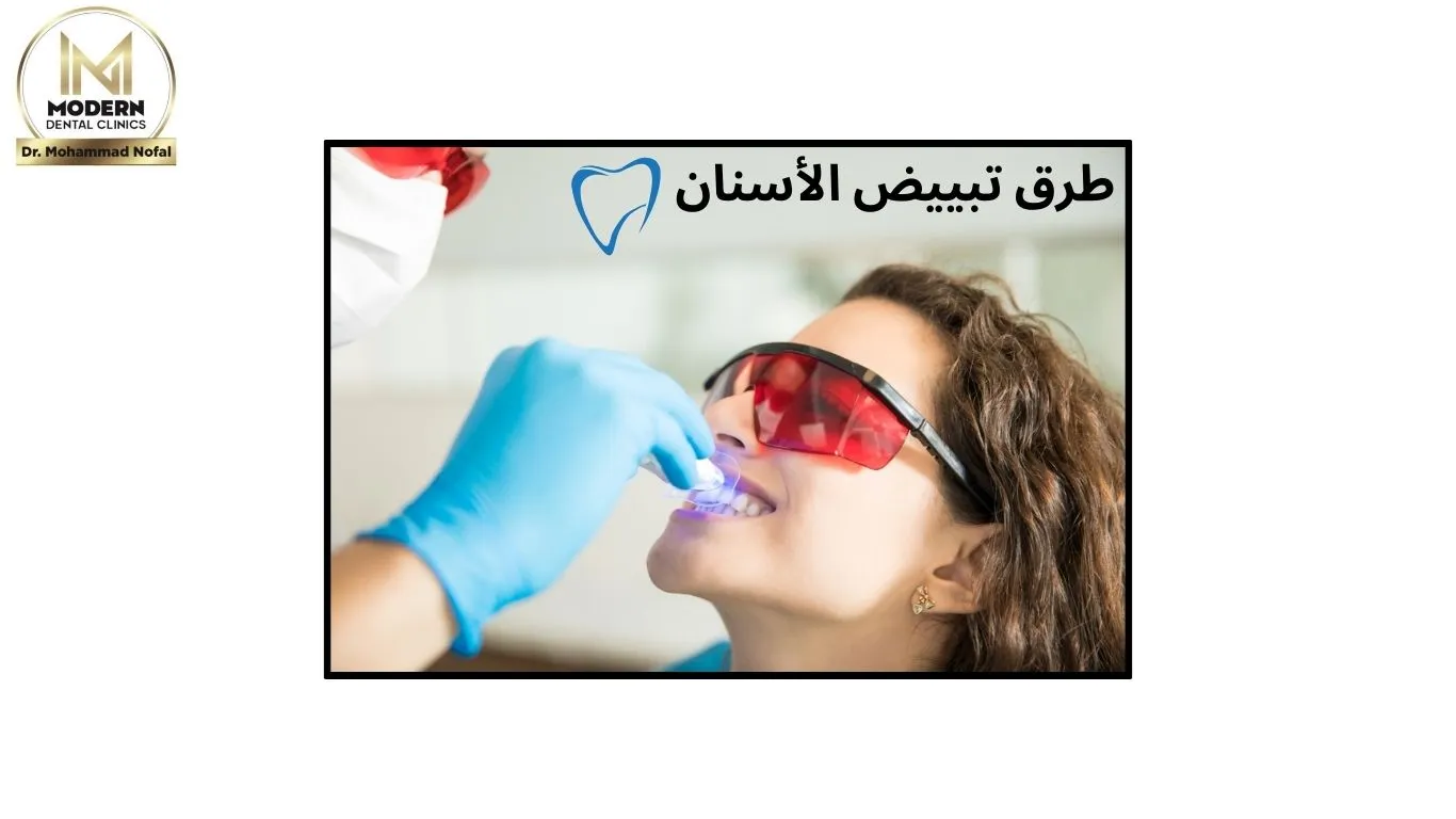 أهم طرق تبييض الأسنان