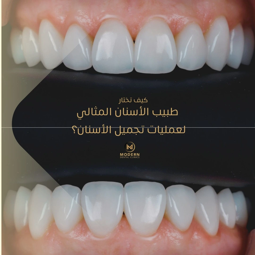 كيف تختار طبيب الأسنان المثالي لعمليات تجميل الأسنان؟