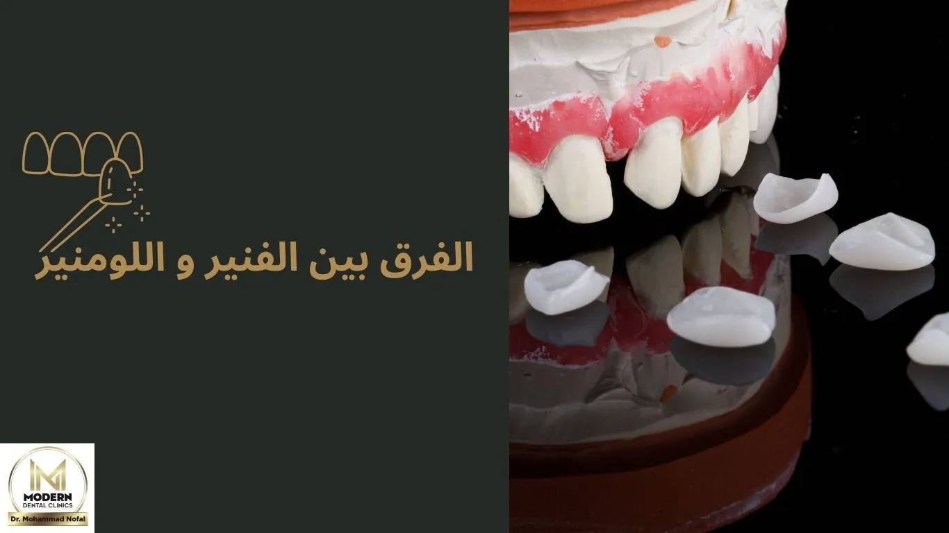 الفرق بين الفنير و لومنير الأسنان