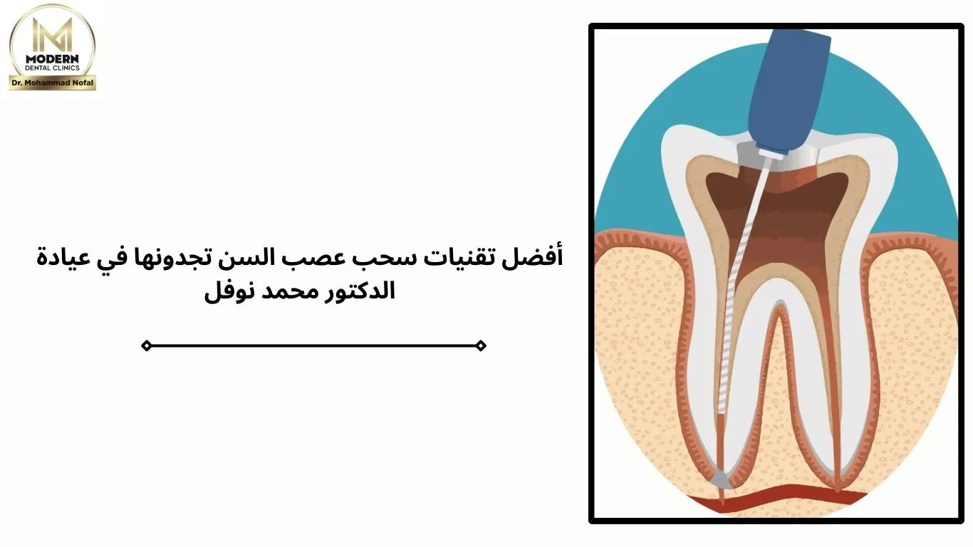 متى يحتاج السن سحب عصب؟