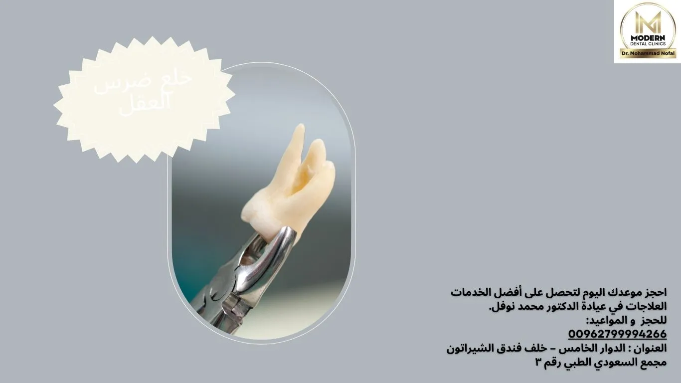 خلع ضرس العقل: متى يكون ضروري؟