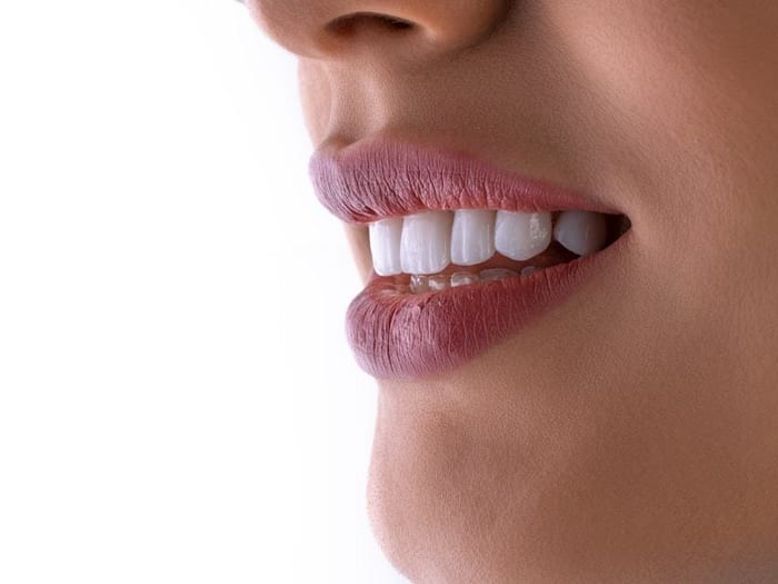 علاج وتجميل اللثة